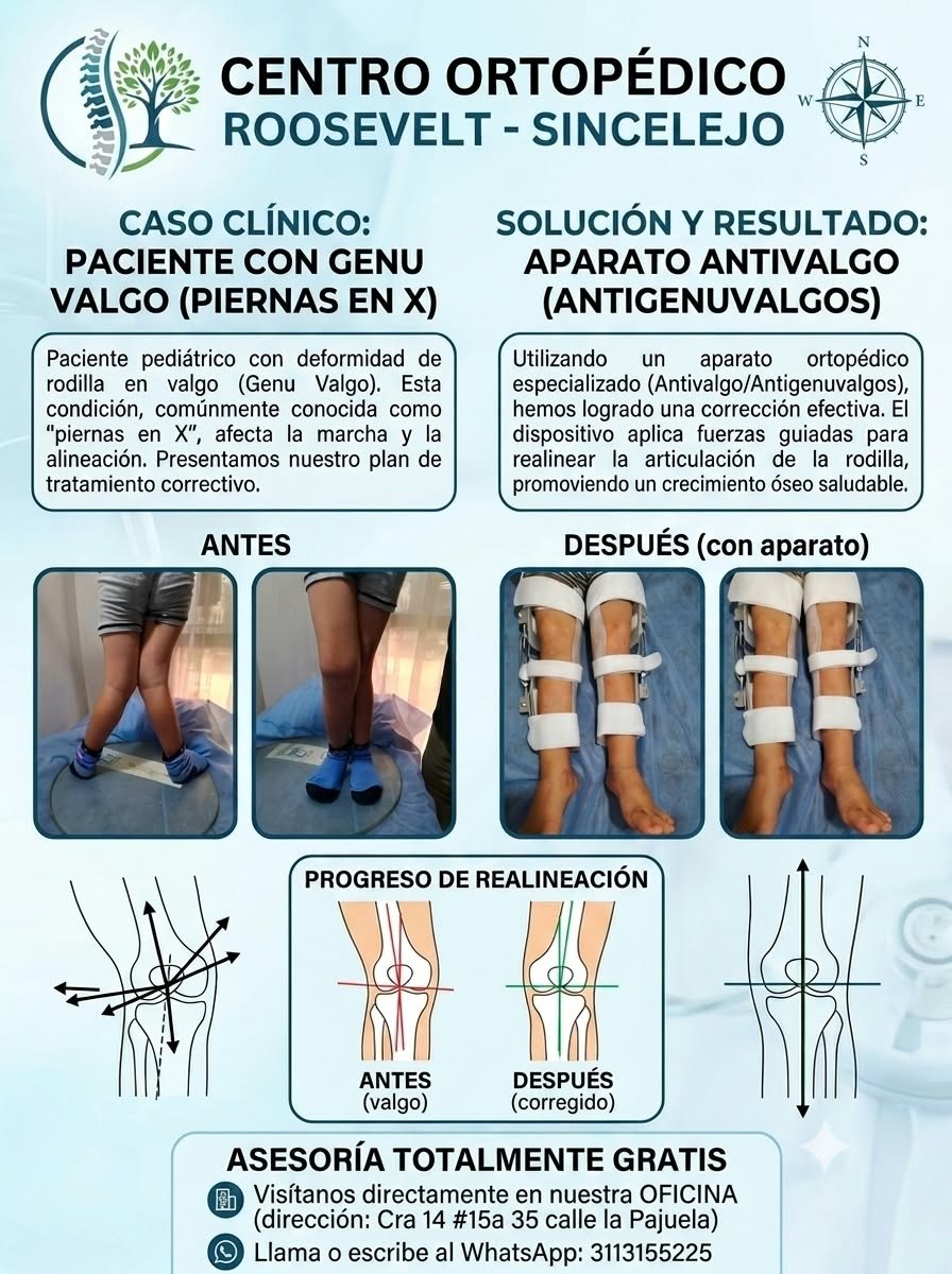 Aparato antivalgo para corrección de genu valgo