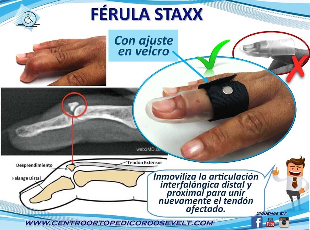 Férula Staxx para dedo con ajuste en velcro